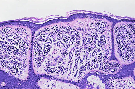 Understanding and Nurturing Your Skin Microbiome: The Key to Healthy Skin