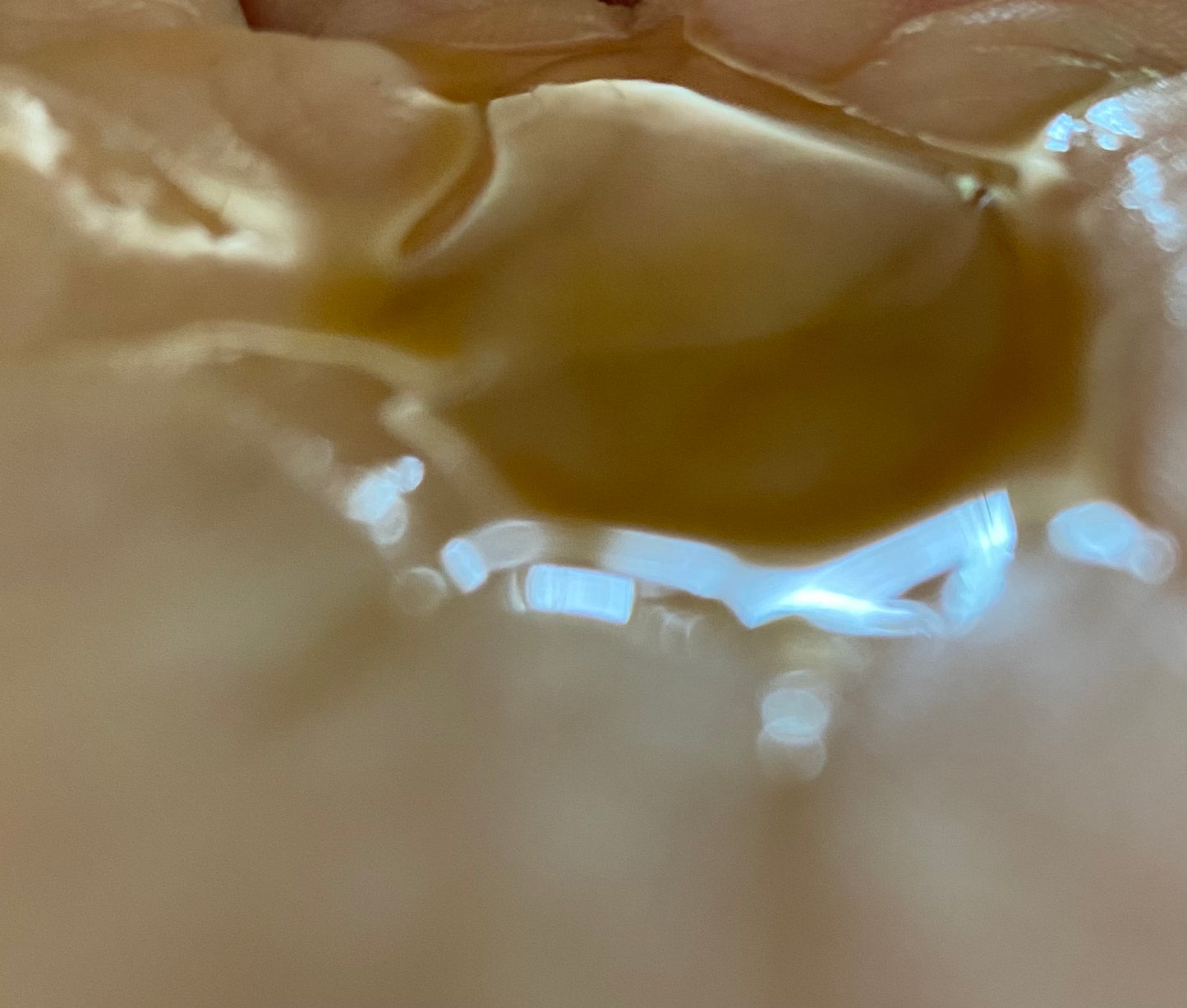 Lipid Lotion