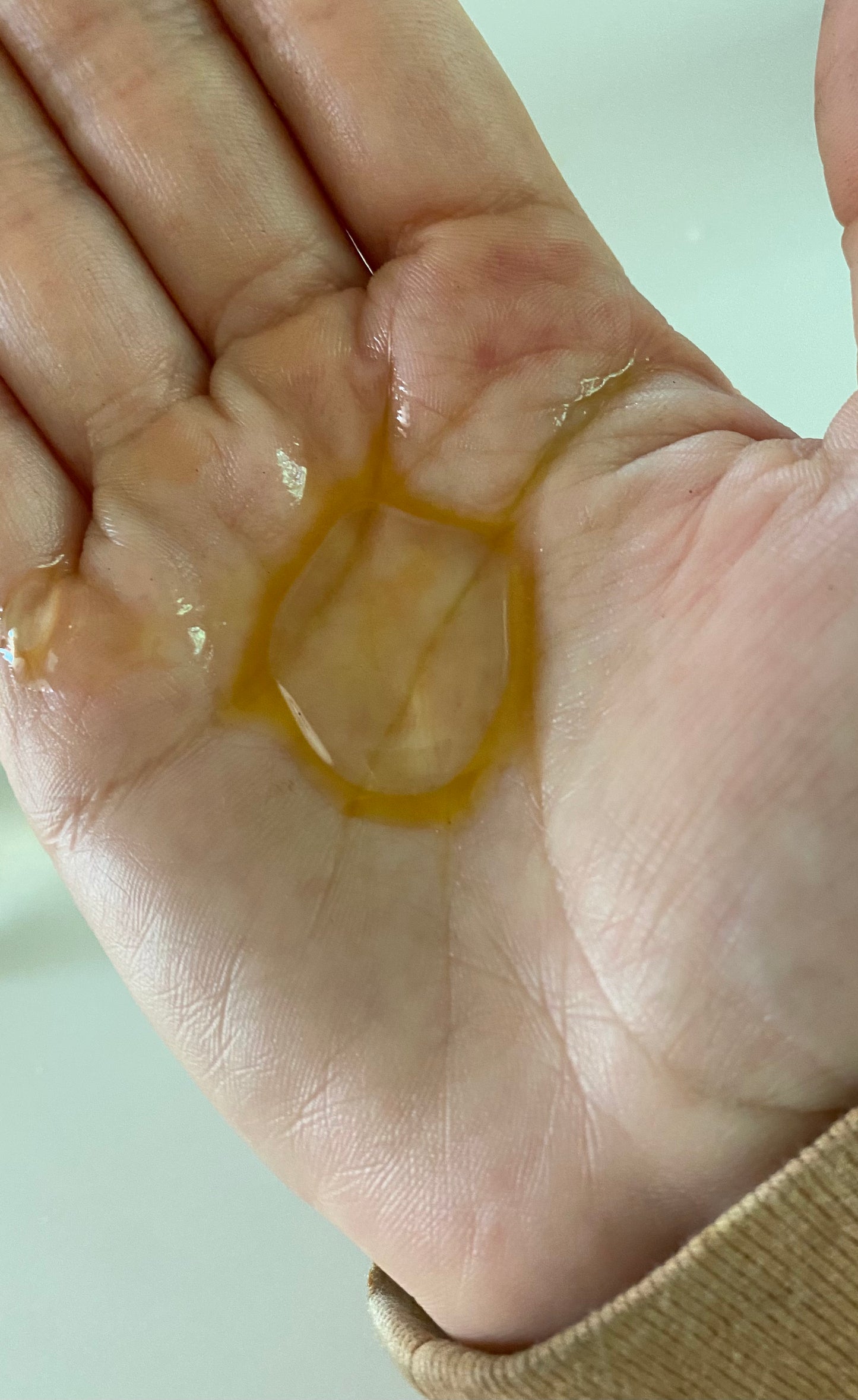 Lipid Lotion