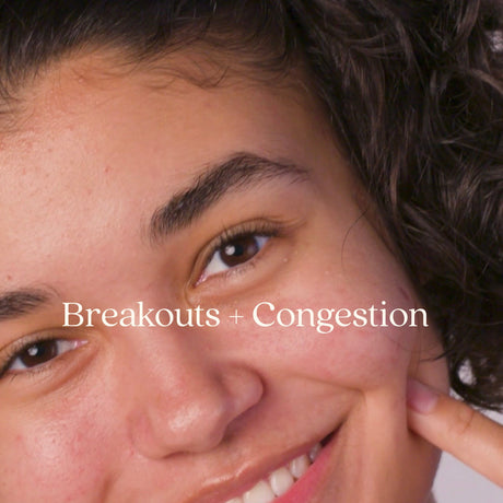 Breakouts + Congestion